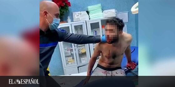  #LoMásLeído | Un hombre se devora a sí mismo en un centro de salud de Murcia tras consumir droga caníbal …