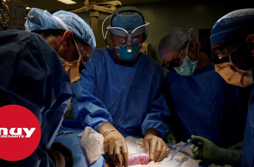  Trasplantan con éxito dos riñones de cerdo a un humano